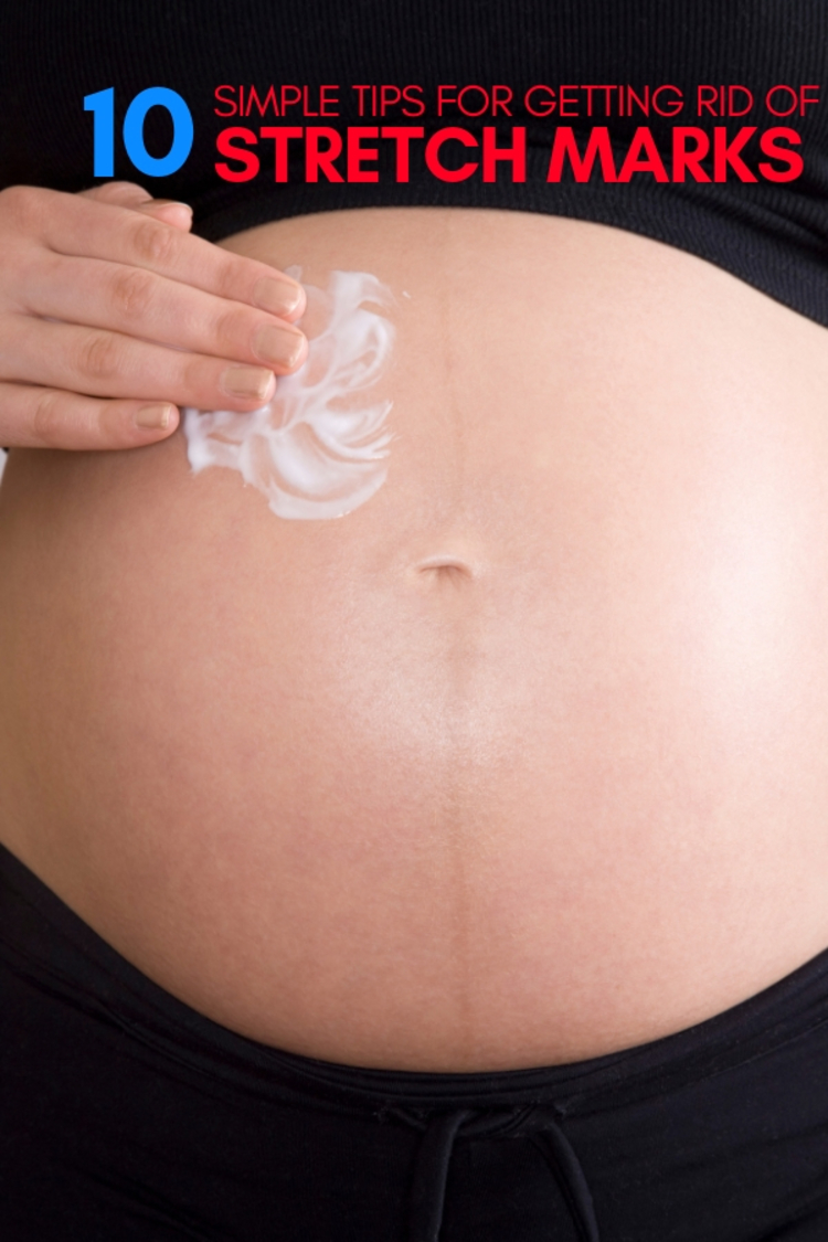 10 Simple Tips for Stretch Marks Removal